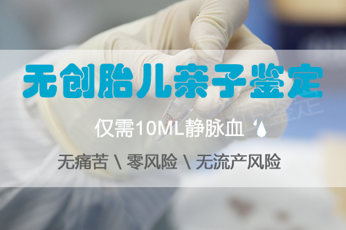 青岛孕期需要怎么做DNA亲子鉴定,青岛孕期血缘检测具体的流程