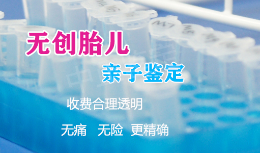 青岛孕期亲子鉴定机构在哪里有,青岛怀孕亲子鉴定预约电话